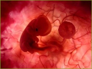 aborto