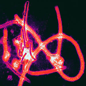 Virus del ebola
